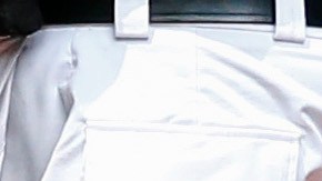 Tras la explosión,  médicos tuvieron que amputarla la pierna al joven.