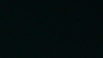 Matt Harvey ya mostraba con su lenguaje corporal del lunes pasado que algo estaba muy mal. Su temporada 2016 termina al decidir operarse.