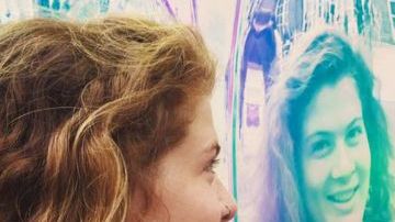 prosopagnosia
