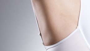 liposuccion