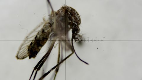 El pequeño falleció poco después de nacer, debido a una microcefalia asociada con el virus del zika.