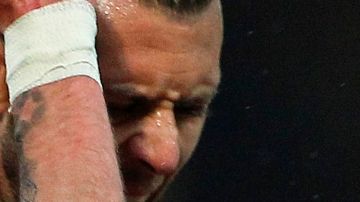 Menez sufre un corte horrible en la oreja en su debut con el Girondins de Burdeaux.