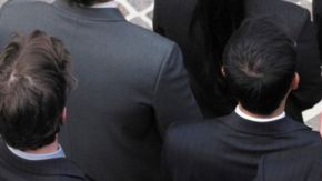 Muchos hombres le dan más importancia a tener cabello que dinero o amigos.