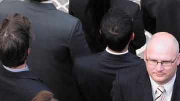 Muchos hombres le dan más importancia a tener cabello que dinero o amigos.