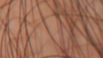 Cerca de 2,600 hombres serán diagnosticados con cáncer de mama invasivo este año.