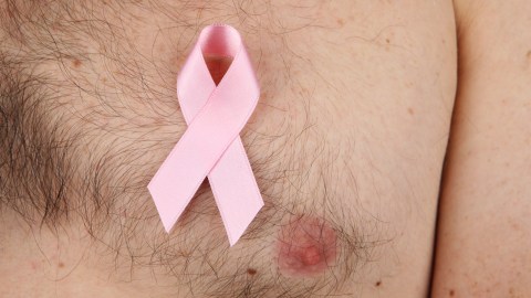 Cerca de 2,600 hombres serán diagnosticados con cáncer de mama invasivo este año.