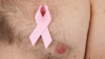 Cerca de 2,600 hombres serán diagnosticados con cáncer de mama invasivo este año.