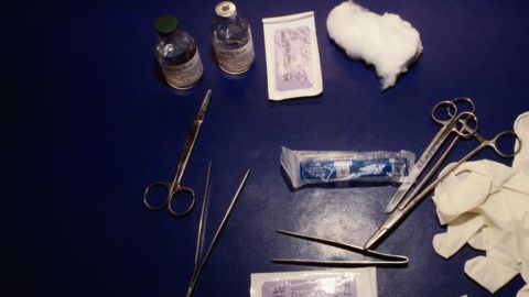 mutilacion