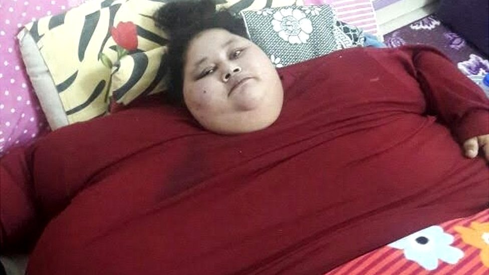 La última esperanza para la mujer más obesa del mundo que pesa casi 500 kilos