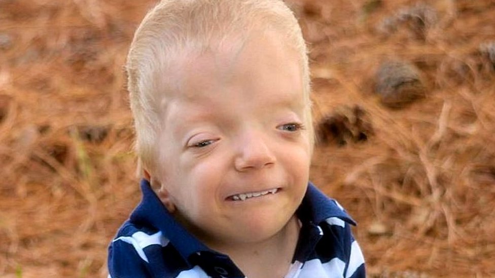 Su hijo está gravemente enfermo y lucha por borrar los memes que se burlan de él