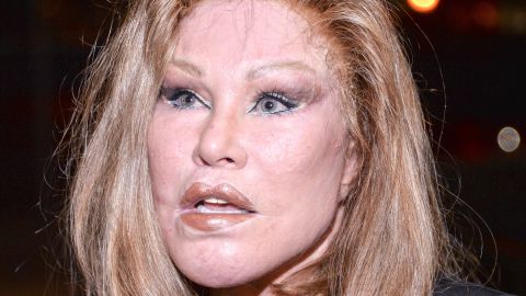 Jocelyne Wildenstein se ha realizado varias cirugías estéticas.