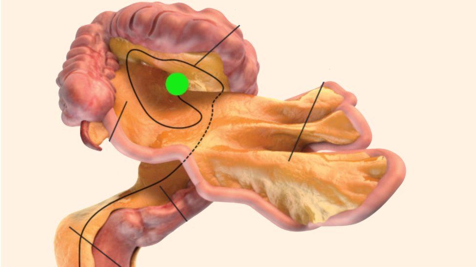Conoce el nuevo órgano del cuerpo descubierto por la ciencia y para qué sirve
