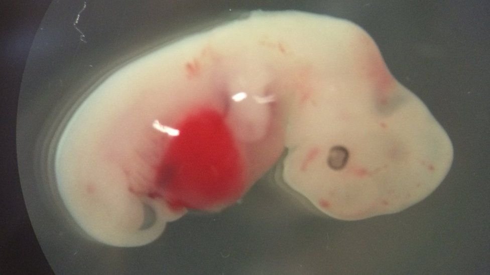 Este es el primer embrión que es un híbrido humano-cerdo