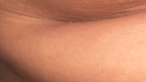 grasa abdomen