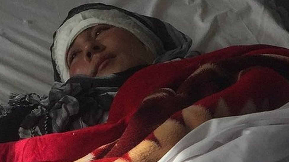 Su esposo la mutiló cruelmente sin aparente razón