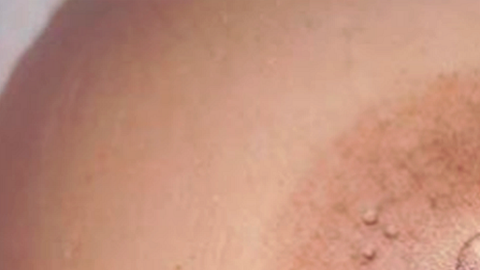 tatuaje pezon