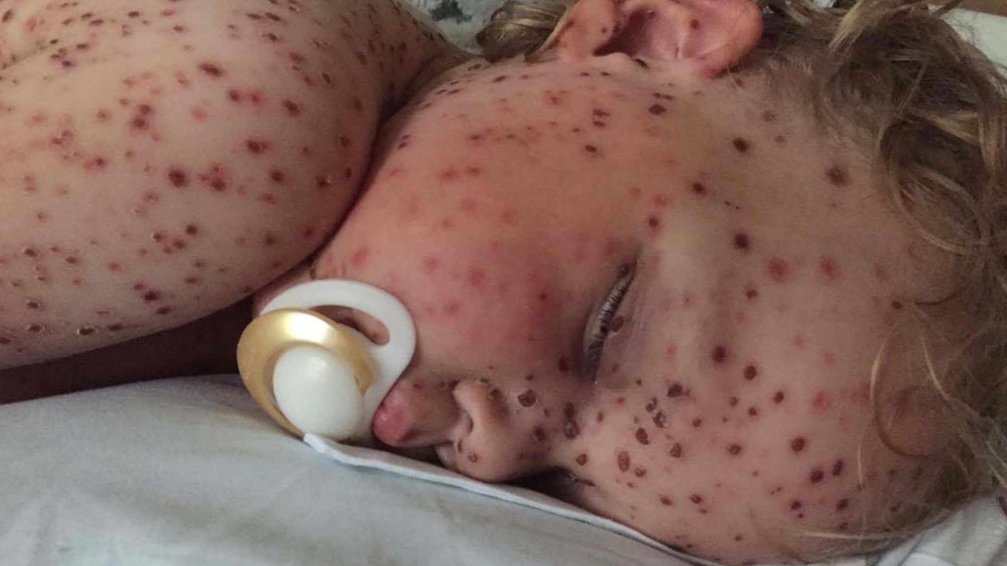 Cuidado con las páginas de Facebook que usan fotos de niños enfermos para estafarte