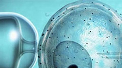 Una mujer fue fecundada con esperma equivocada.