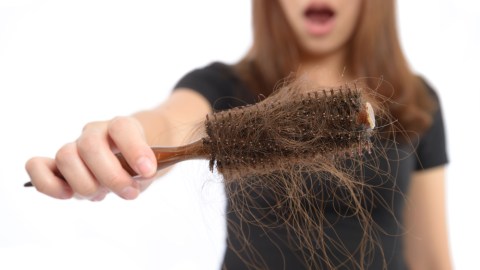 caida cabello