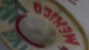 Salvadoreña con tumor en la cabeza, Sara Beltrán, 26 años, salió de la cárcel de inmigración hace un mes y se reunión con su familia en Queens.