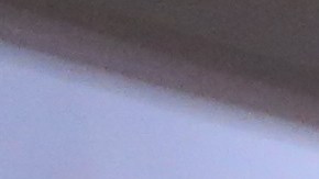 Salvadoreña con tumor en la cabeza Sara Beltan,26 años, salio de la carcel de inmigracion hace un mes y se reunion con su familia en Queens.