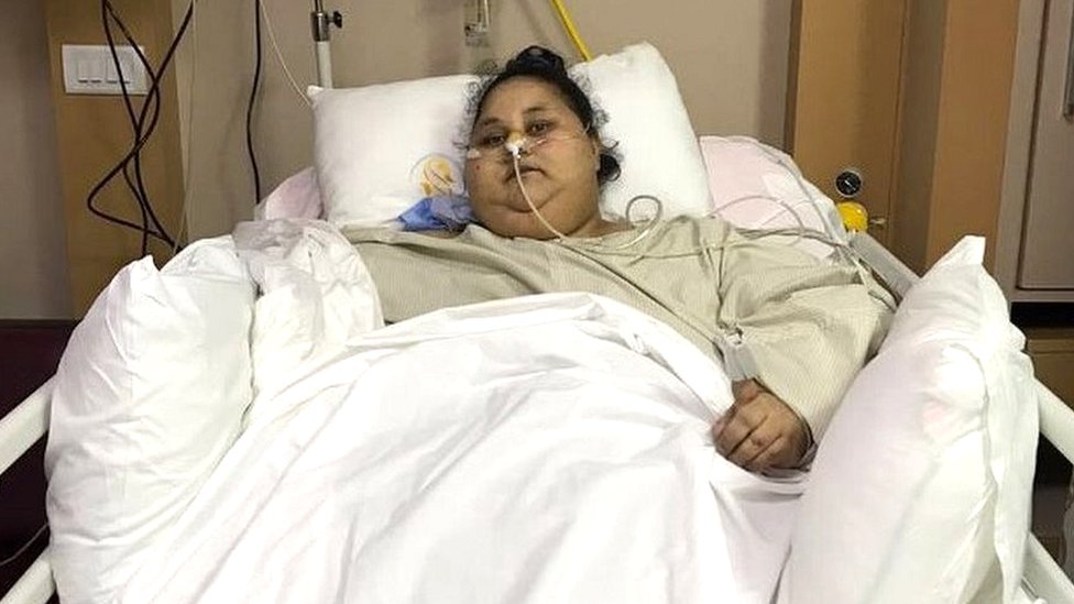 La mujer más obesa del mundo pasó de 1,100 a 880 libras luego de una cirugía bariátrica