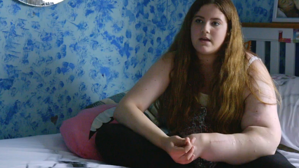 El brazo izquierdo de esta niña no deja de crecer por un trastorno genético