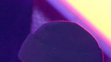 Esta no es la primera vez que peligra su seguridad sobre el escenario.