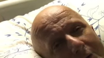 Paco Sanz simuló que era paciente del síndrome de Cowden para robarle dinero a usuarios de redes.