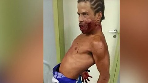 El sujeto había sido trasladado al centro hospitalario por una herida de bala en el maxilar.