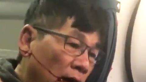 David Dao fue obligado a abandonar un avión de United Airlines con la cara manchada de sangre.