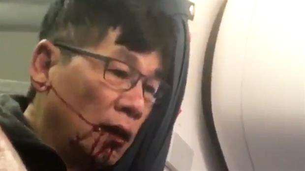 David Dao fue obligado a abandonar un avión de United Airlines con la cara manchada de sangre.