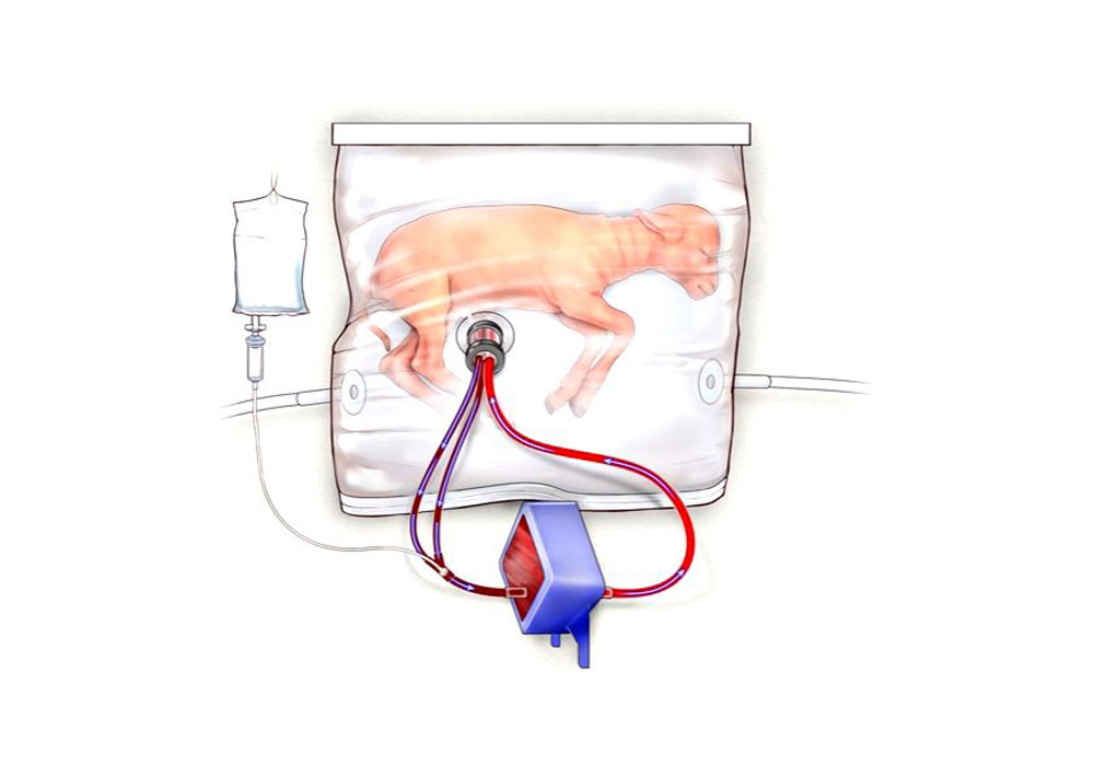 Video: Así funciona el útero de plástico que mantiene con vida fetos prematuros