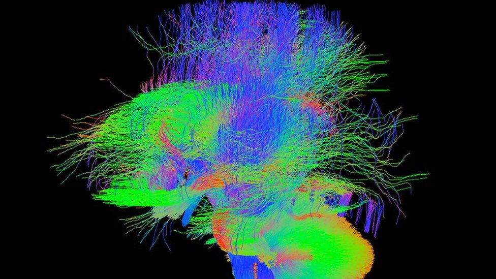 Fotos: Así se forman trillones de conexiones en el cerebro de los bebés dentro del útero