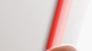 Acudir al dentista se está volviendo un lujo en EEUU.