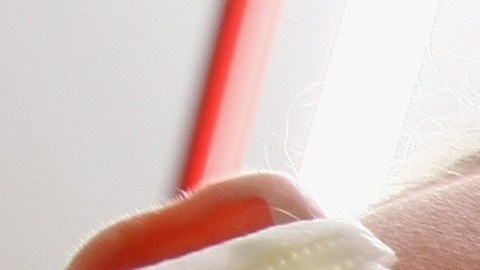 Acudir al dentista se está volviendo un lujo en EEUU.