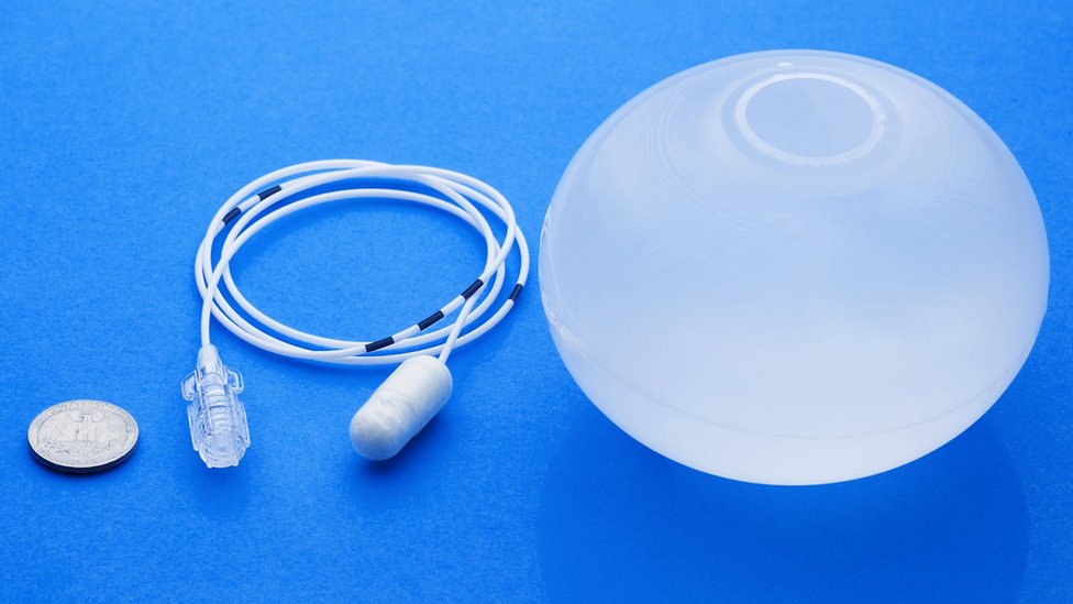 El globo gástrico para bajar más de 20 libras sin cirugía