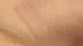 Linda Mcfaline supo que tenía una infección en sus implantes de seno desde el momento en que los mismo comenzaron a enrojecerse.