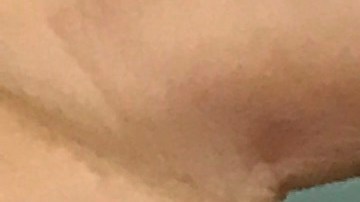 Linda Mcfaline supo que tenía una infección en sus implantes de seno desde el momento en que los mismo comenzaron a enrojecerse.