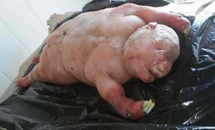 La cría tiene cabeza y orejas con forma humana, pero tiene patas y pezuñas.