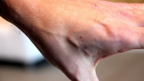 Unos 50 empleados recibirán el implante de un chip entre el índice y el pulgar en una funda de cristal poco más grande que un grano de arroz.