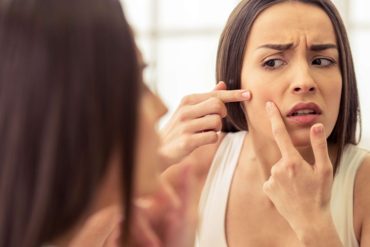 Hay medidas preventivas que nos permiten librarnos del acné.