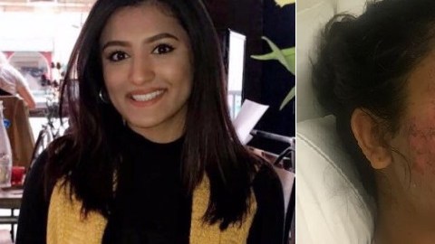 La familia publicó imágenes en gofundme.com