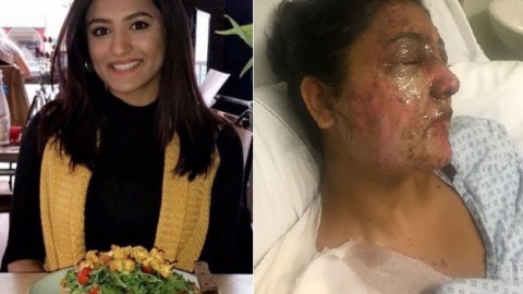 La familia publicó imágenes en gofundme.com