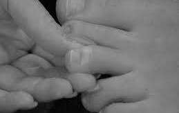 Una infección tras una pedicura se extendió a los huesos y la víctima debió someterse a cirugía.