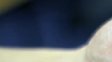 Robot para enfermedades digestivas