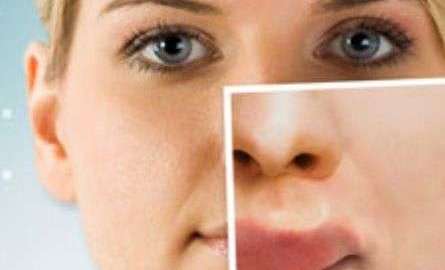 Mujer con labios hinchados no puede respirar.