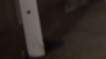 Además de microcefalia, el Zika provoca en pocos año, otras discapacidades.