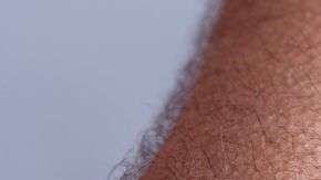 La piel de gallina nos ayudaba a mantener el calor y a aislarnos del frío.