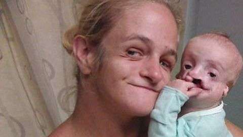 Zoey Tidwell tendrá que someterse a cirugía desde ahora hasta los 18 años cada seis meses.